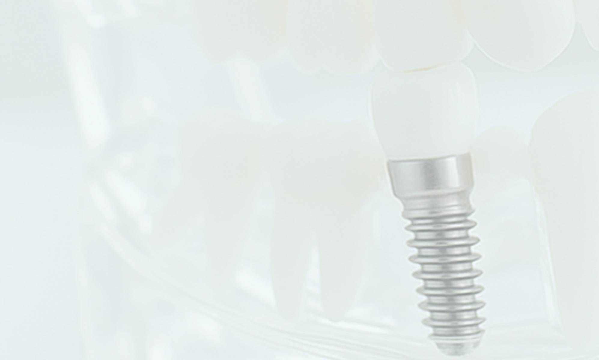 インプラント IMPLANT